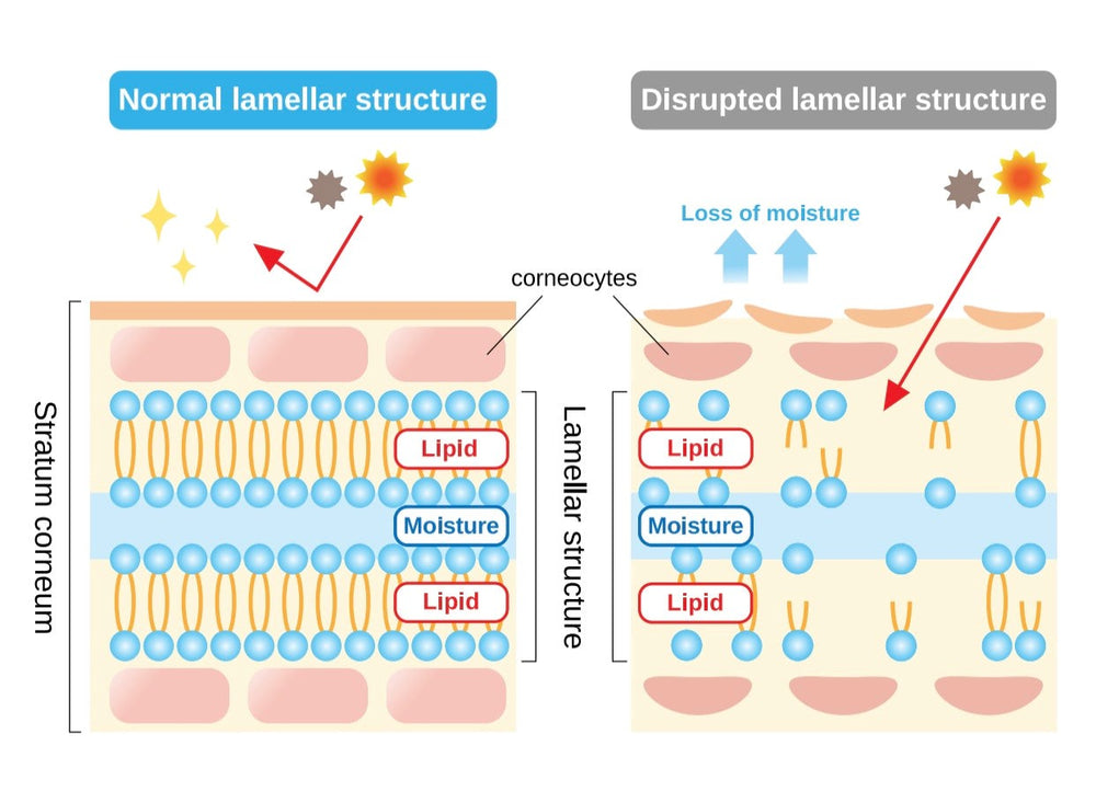 Protecting Your Skin Barrier