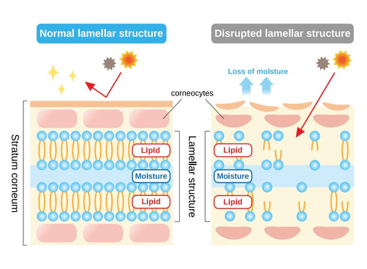 Protecting Your Skin Barrier
