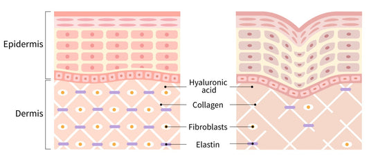 Fine Lines and Wrinkles