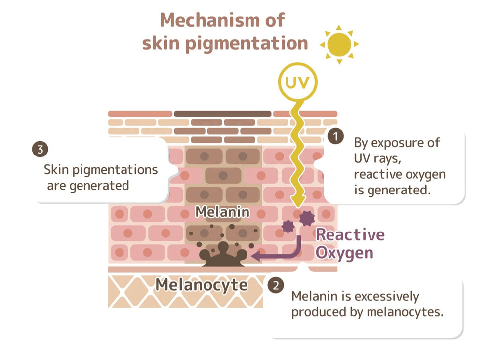 Root Cause of Skin Pigmentation